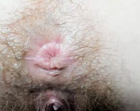 Extra cloused wink hairy asshole